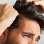 What Makes Hair Transplant So Popular Today